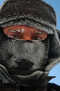 Frozen face: It's cold outside!