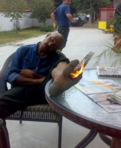 The Burnt Foot Picture The Burnt Foot Picture